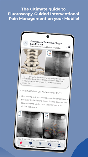 Interventional Pain App Captura de pantalla 4