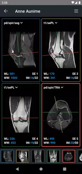 IDV - IMAIOS DICOM Viewer Скриншот 3