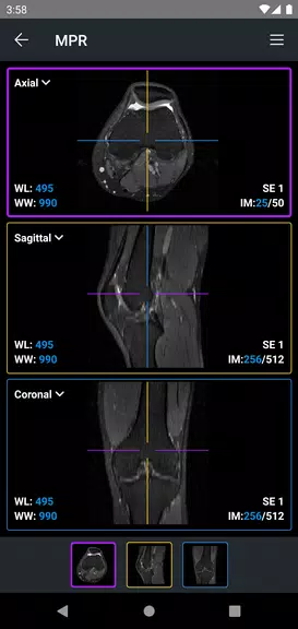 IDV - IMAIOS DICOM Viewer Скриншот 4