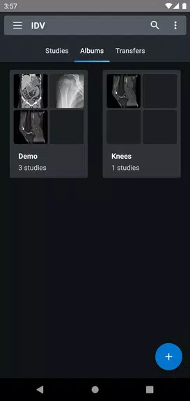 IDV - IMAIOS DICOM Viewer Скриншот 2