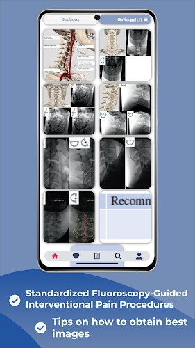 Interventional Pain App Captura de pantalla 3